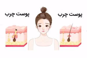 روتین مراقبت پوست چرب؛ آموزش گام‌به‌گام و خرید اقتصادی
